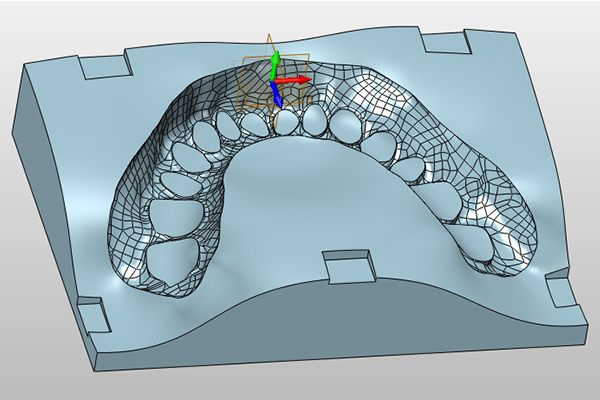 Dental mold